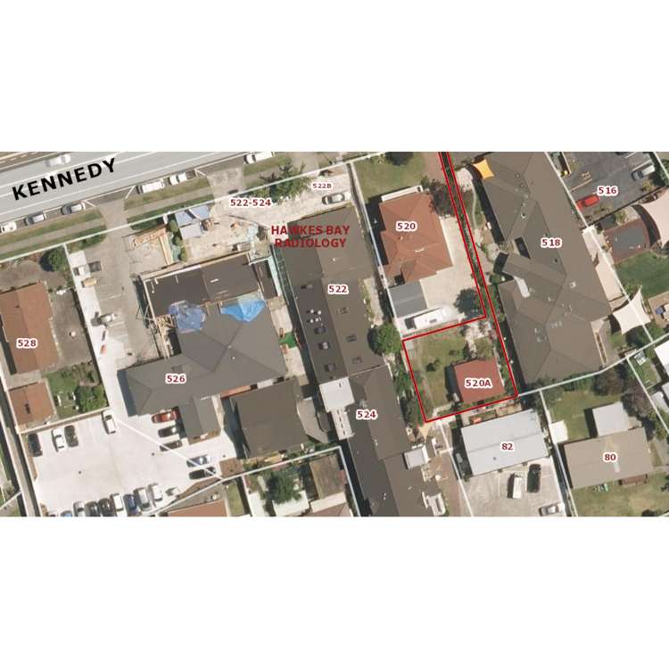 520a Kennedy Road Greenmeadows_13